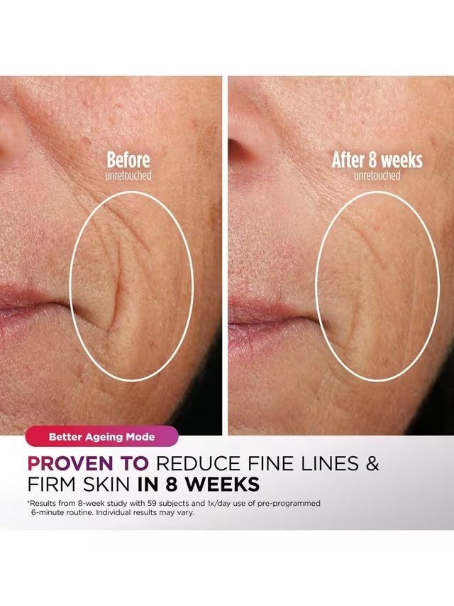 Shark CryoGlow FW312UK LED Anti-Ageing & Blemish Repair Face Mask - Lilac